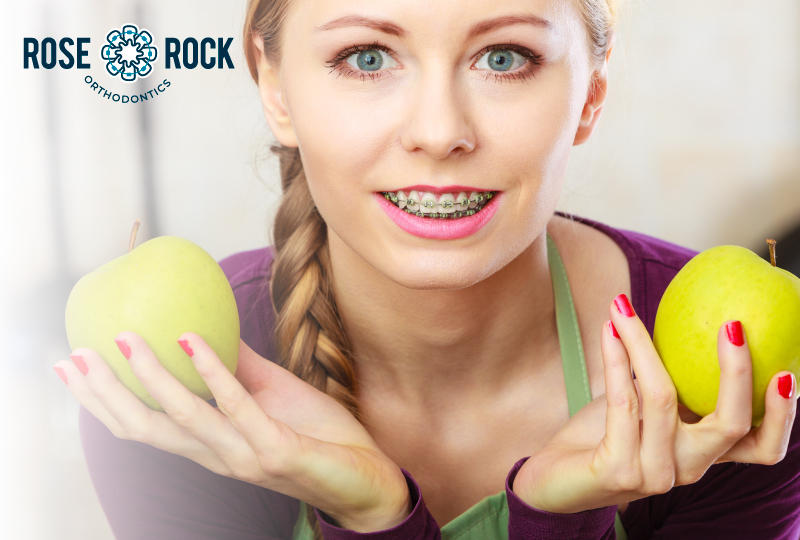 What you eat with braces on will greatly impact your treatment.